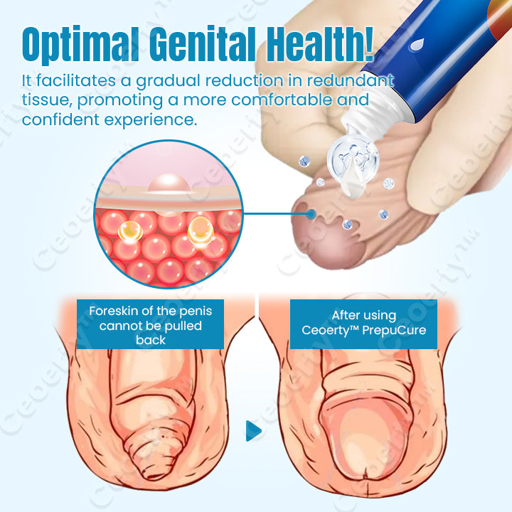 🧴🍆 gel corrector y agrandador de prepucio Ceoerty™ PrepuCure🍆🧴