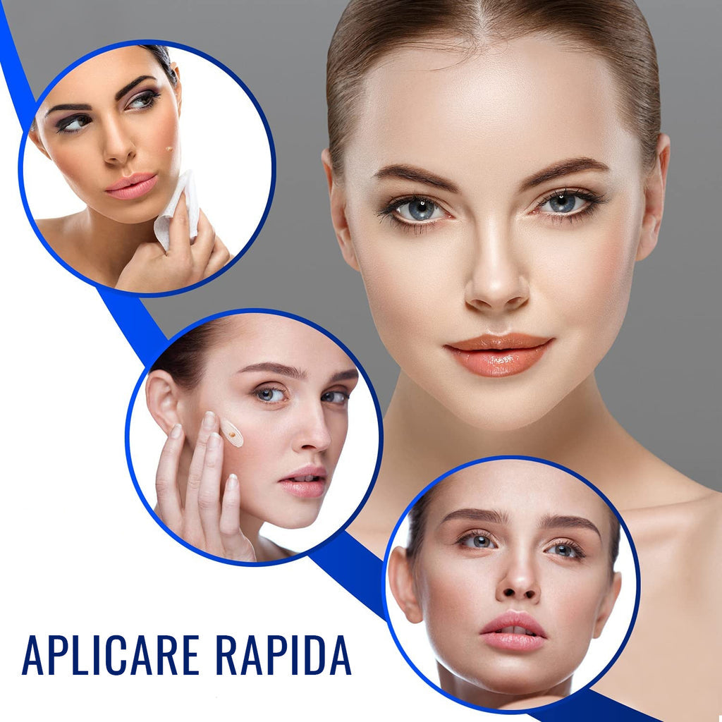 KIT 2X1🔥+ (gratis copitos tipo quirúrgicos) WART BLACKHEADS® │Removedor automatico de verrugas│⭐⭐⭐⭐⭐
