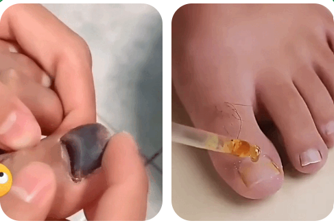 Suero Restaurador De Uñas