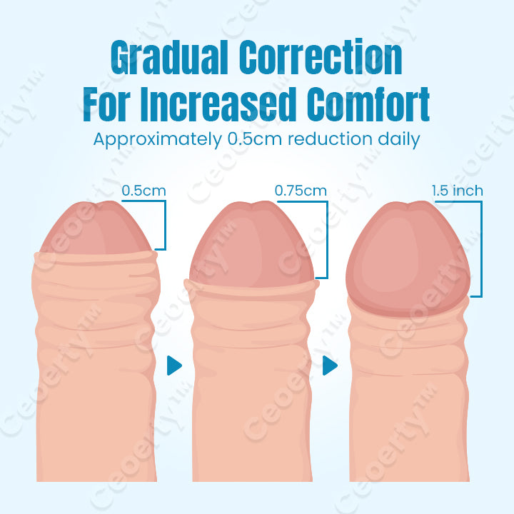 🧴🍆 gel corrector y agrandador de prepucio Ceoerty™ PrepuCure🍆🧴