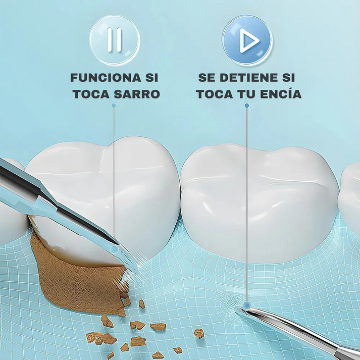 🦷✨Dentify® | Removedor de Sarro Magnético (gratis 3 boquillas) 🔥
