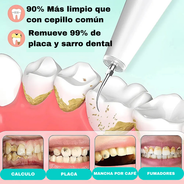 🦷✨Dentify® | Removedor de Sarro Magnético (gratis 3 boquillas) 🔥