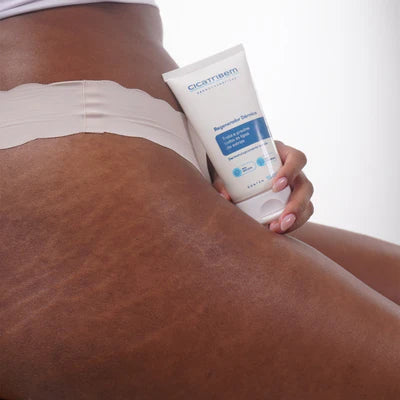Crema regeneradora dérmica antiestrías
