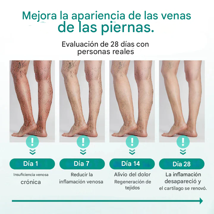 (Set x 8 tratamiento semanal) parche tópico para venas varices