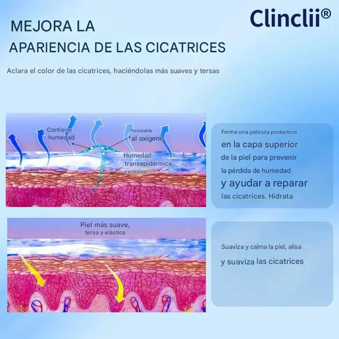 Clinclii® Gel de silicona médica para cicatrices✨ Atenúa cicatrices quirúrgicas, estrías, queloides y cicatrices de cesárea