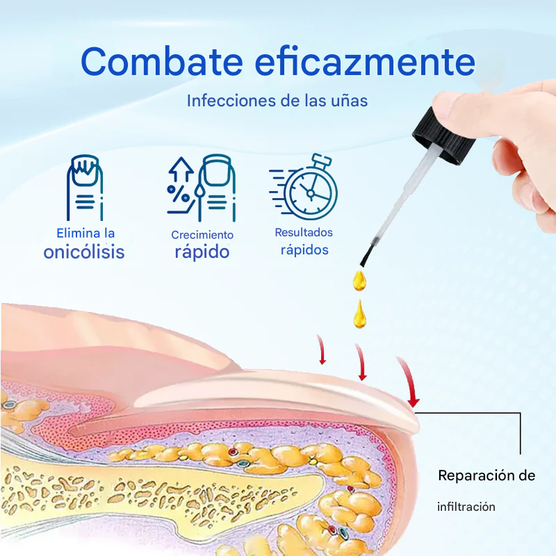 Biancat® OnyxoGuard Suero para el crecimiento y la reparación de uñas