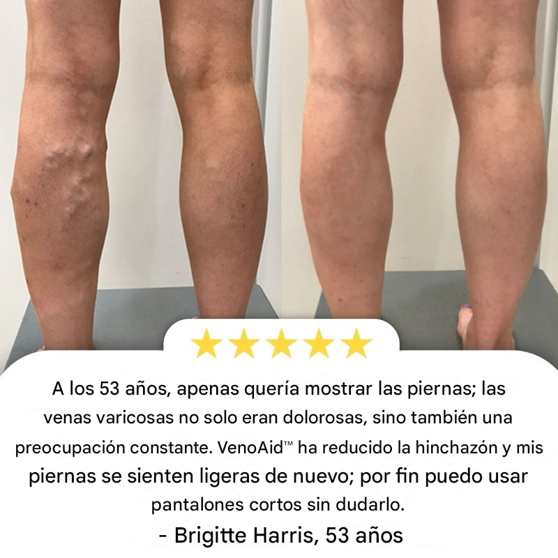 Balanlogy - Solución en aerosol para venas varicosas