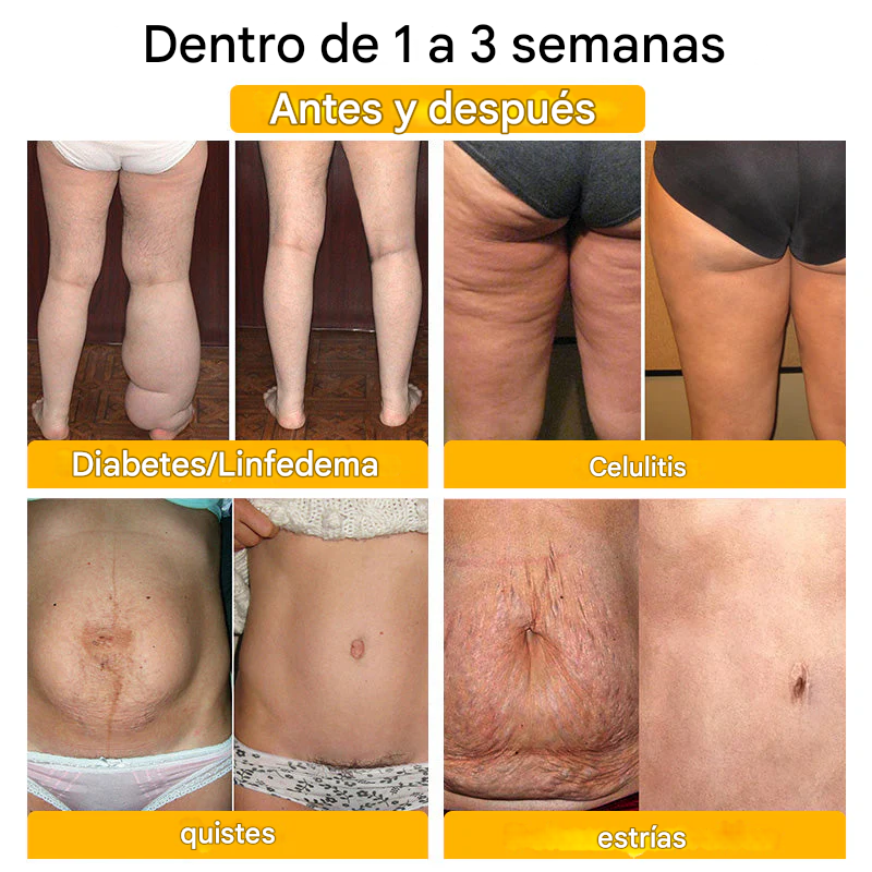 Shorts moldeadores Anyidea® de fibra de titanio y turmalina de grado médico (TALLA UNICA)