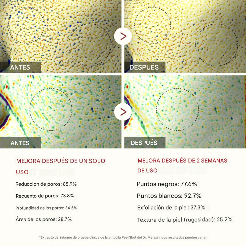Dúo exfoliante de arroz: elimina al instante la piel muerta para una piel suave y radiante.