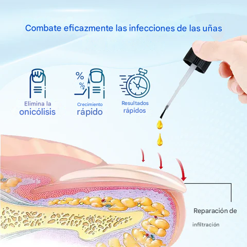 OnyxoGuard Suero para el crecimiento y la reparación de uñas