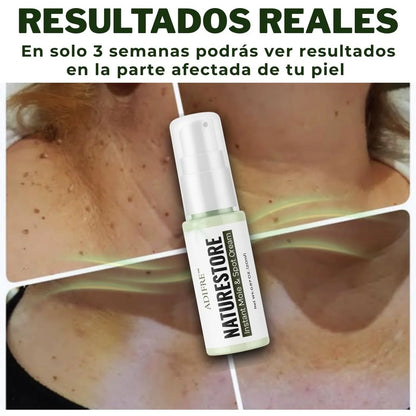 AdFire™ Eliminador Total de Verrugas e Imperfecciones_medicado