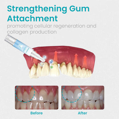 Tratamiento en Gel para ENCIAS 🦷🌟