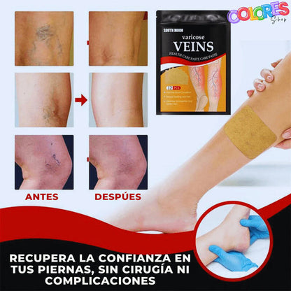 Paga 1 Lleva 3 (36unds) Parches Naturales Para Varices Y Para Las Piernas Cansadas - VeinPatch™