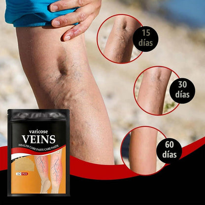 Paga 1 Lleva 3 (36unds) Parches Naturales Para Varices Y Para Las Piernas Cansadas - VeinPatch™