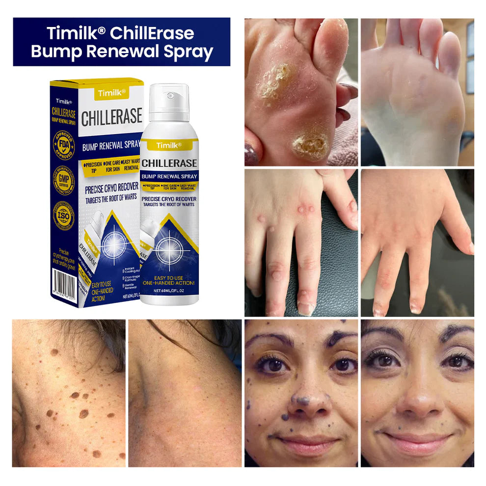 👩‍⚕️Spray removedor de imperfecciones✨ Timilk® ChillErase