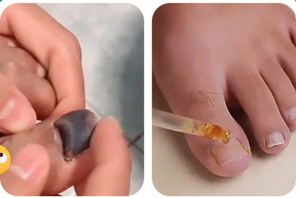 Suero Restaurador De Uñas