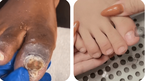 Suero Restaurador De Uñas