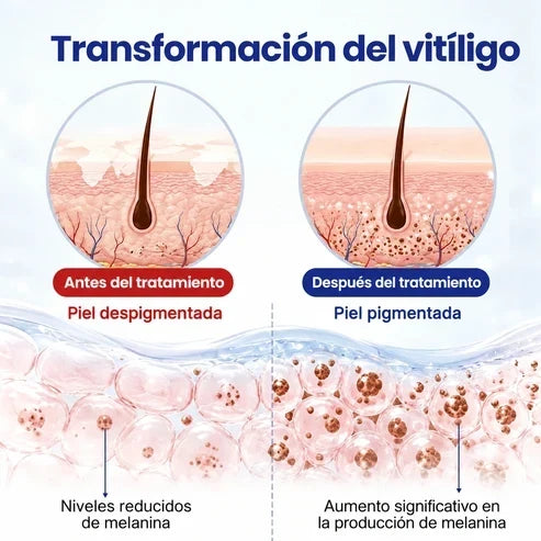 VitiRepair - Spray avanzado para el vitiligo y parches blancos
