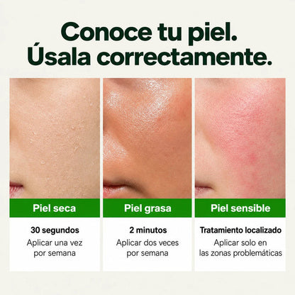 🔥PROMO 2X1 🔥Nueva GREEN TOMATO™ - Limpieza Profunda De Poros Y Puntos Negros ✨