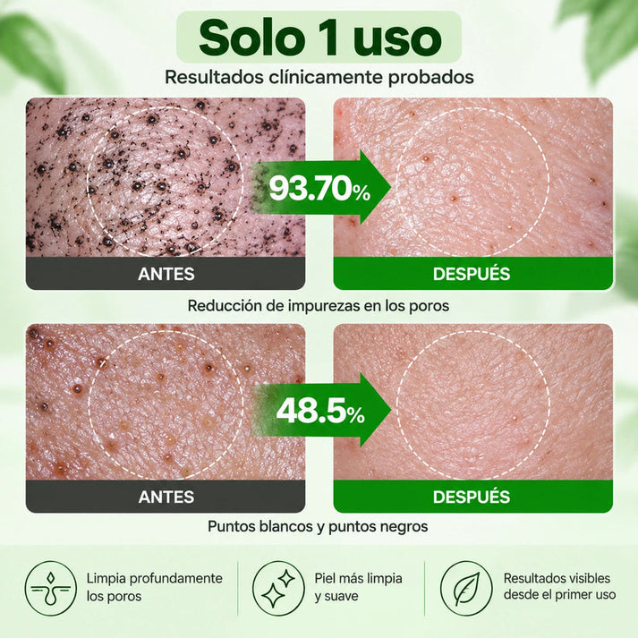🔥PROMO 2X1 🔥Nueva GREEN TOMATO™ - Limpieza Profunda De Poros Y Puntos Negros ✨