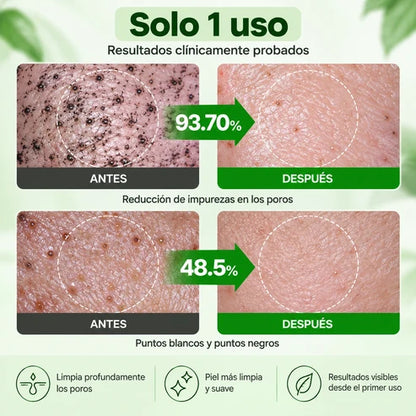 ProctoEase - Gel para hemorroides con barrera protectora avanzada