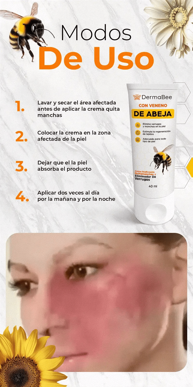 DermaBee Con Veneno De Abeja Elimina Manchas En La Piel