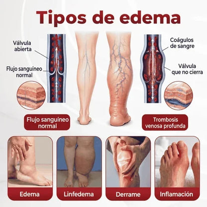 SwellVeil - Crema para la circulación de piernas