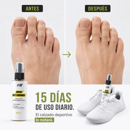 Paga 1 Lleva 2 Spray Anti Hongos para Pies y Calzado 60ml