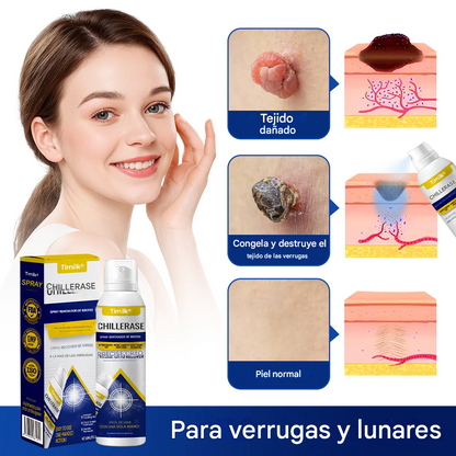 👩‍⚕️Spray removedor de imperfecciones✨ Timilk® ChillErase