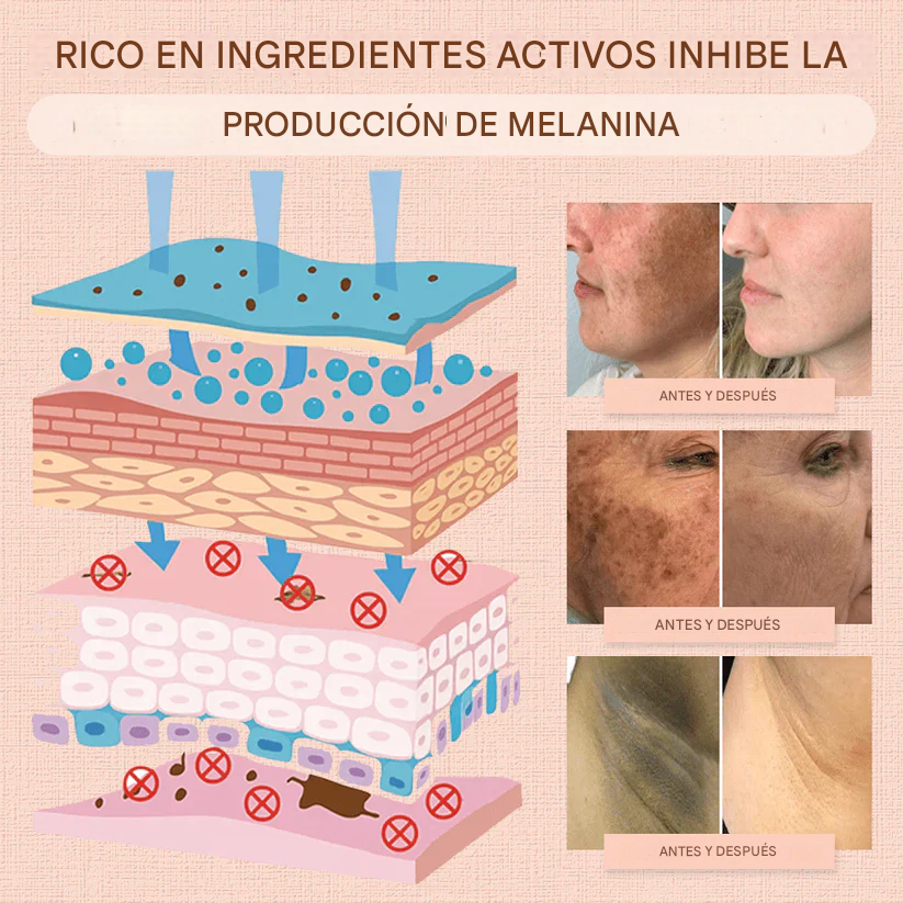 Gel exfoliante purificante Fivfivgo® para acantosis nigricans, exfoliación, manchas oscuras, verrugas y eccema.