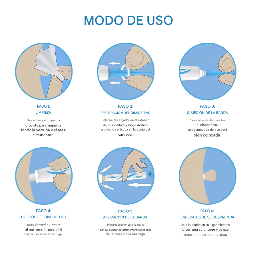 Lápiz Bikenda® para la eliminación indolora de verrugas cutáneas en casa