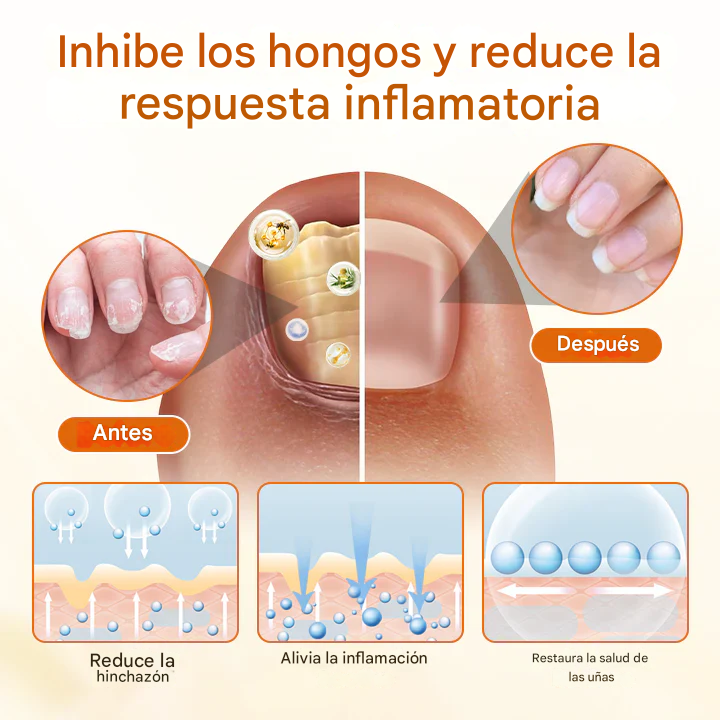 FungiBee Fivfivgo®🐝 Spray reparador de uñas🫸✨ avanzado