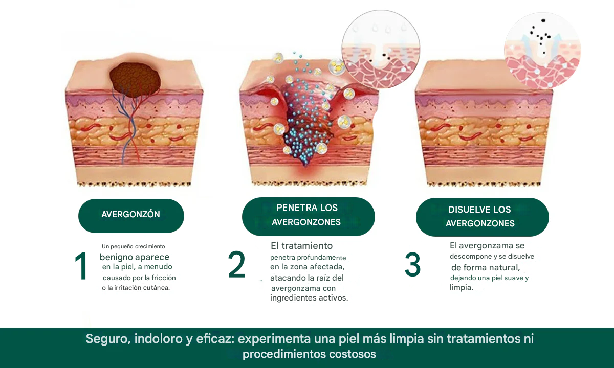 Parches de magnesio Luhaka® elimina verrugas✨ (6 unidades reutilizables)👩‍⚕️