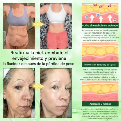 🧑‍⚕️🩺 Moringa · Berberina × NAD+ 10-in-1 Paquete de Moringa de Nino Advanced — Solo Día, Visibelio 𝐑𝐞𝐬𝐮𝐥𝐭𝐬 𝐢𝐧 𝟕 𝐃𝐚𝐲𝐬✨