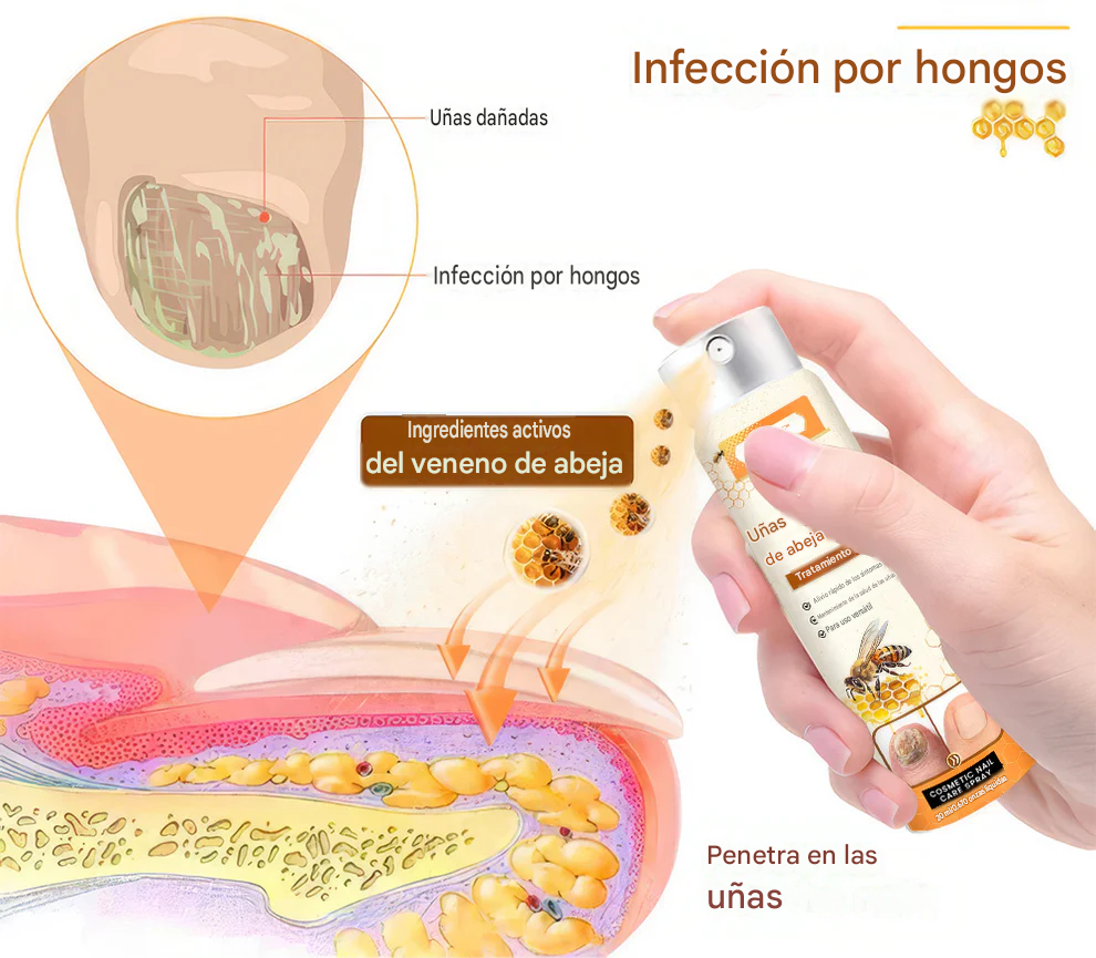 UNPREE™ Spray para hongos en las uñas con veneno de abeja Kolirin 💥