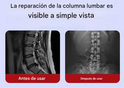 Parches De Terapia articular🦴Osea para cuello y hombros