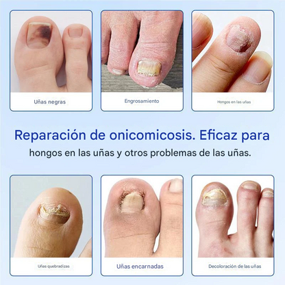 Parches para la renovación de uñas durante la noche