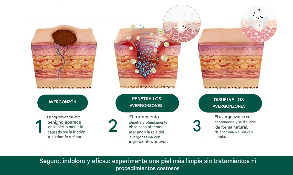 Parche de magnesio reutilizable Luhaka® para eliminar verrugas