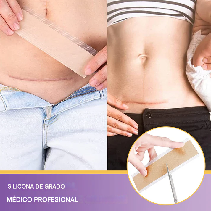 Oveallgo® RejuveSkin Tape (1.5 Metros)