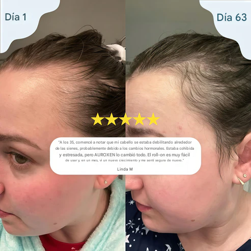 Paga 1 Lleva 2 AUROXEN Roll-On Renovador del Cuero Cabelludo