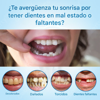 HZA™ --🦷Juego avanzado de prótesis dentales completas personalizadas🦷