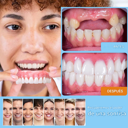 HZA™ --🦷Juego avanzado de prótesis dentales completas personalizadas🦷
