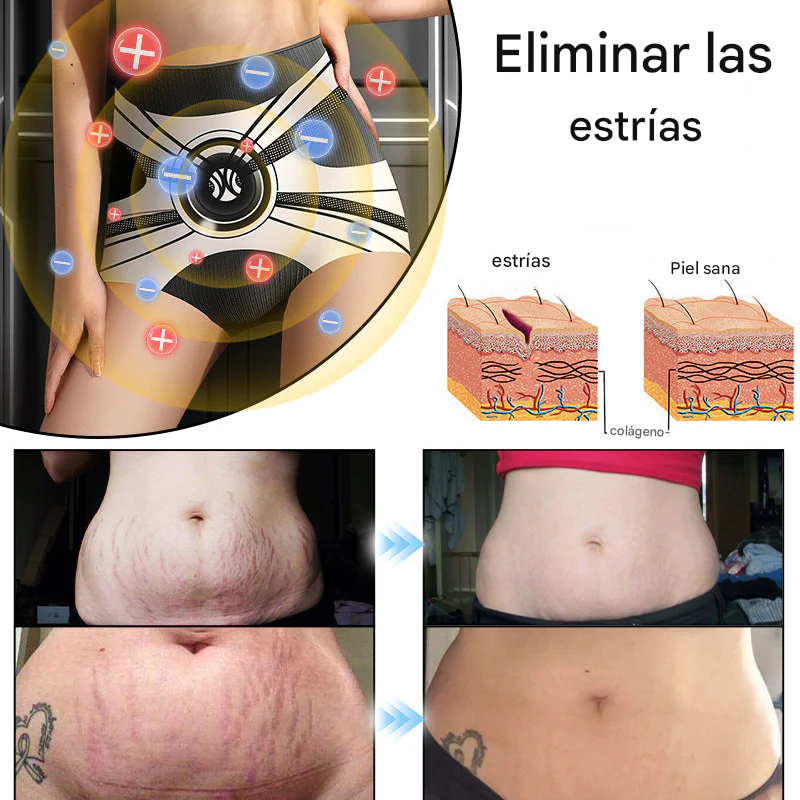 Shorts moldeadores Anyidea® de fibra de titanio y turmalina de grado médico (TALLA UNICA)