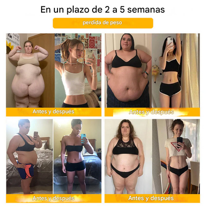 Shorts moldeadores Anyidea® de fibra de titanio y turmalina de grado médico (TALLA UNICA)