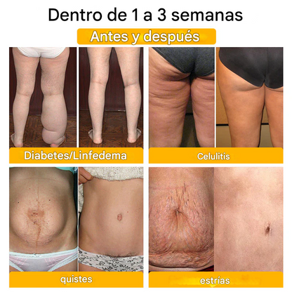 Shorts moldeadores Anyidea® de fibra de titanio y turmalina de grado médico (TALLA UNICA)