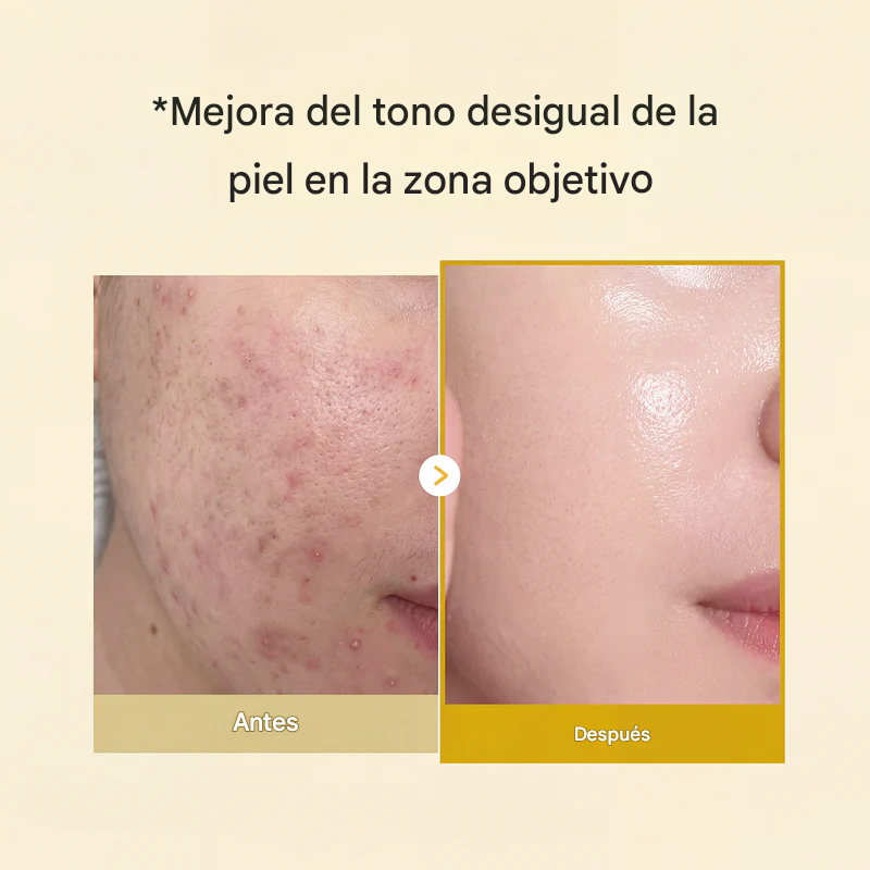Despierta con una piel más radiante gracias a la mascarilla envolvente de ácido kójico y cúrcuma.