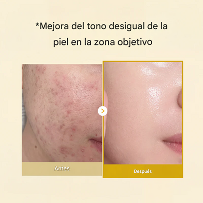 Despierta con una piel más radiante gracias a la mascarilla envolvente de ácido kójico y cúrcuma.