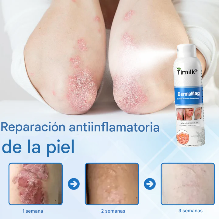 Timilk® DermaMag Magnesium Repair Spray 🔥 Certificado por la FDA