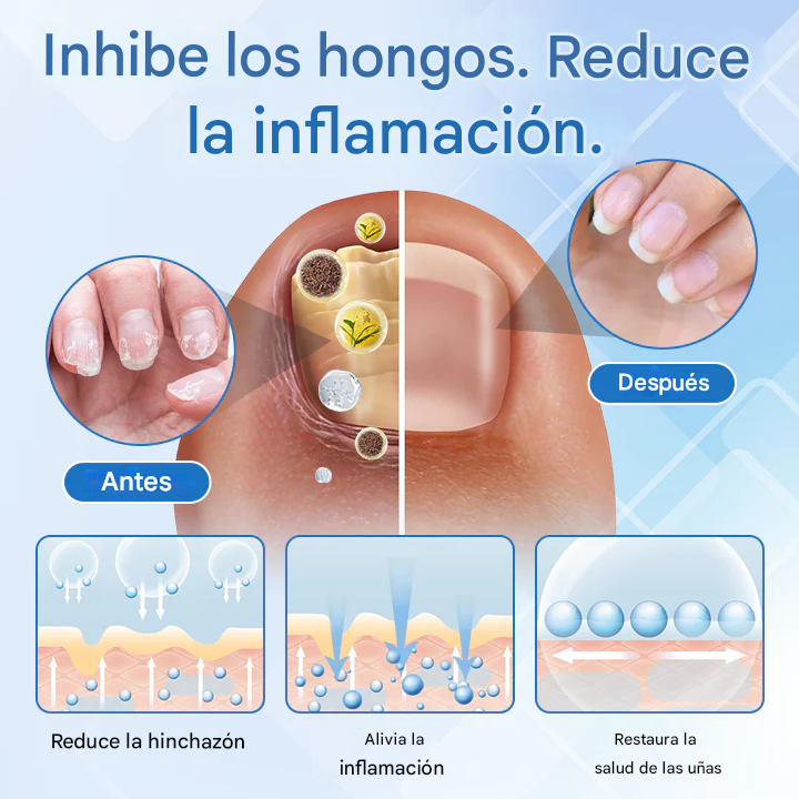 Timilk® DermaMag Magnesium Repair Spray 🔥 Certificado por la FDA