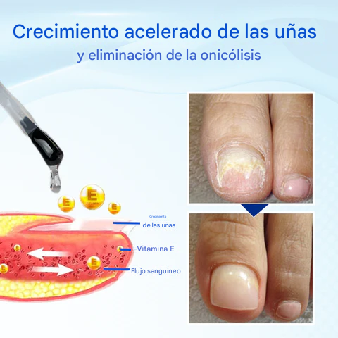 OnyxoGuard Suero para el crecimiento y la reparación de uñas